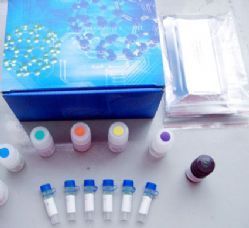 人免疫球蛋白輕鏈lambda（λ-IgLC）ELISA Kit 產(chǎn)品說(shuō)明與價(jià)格解析